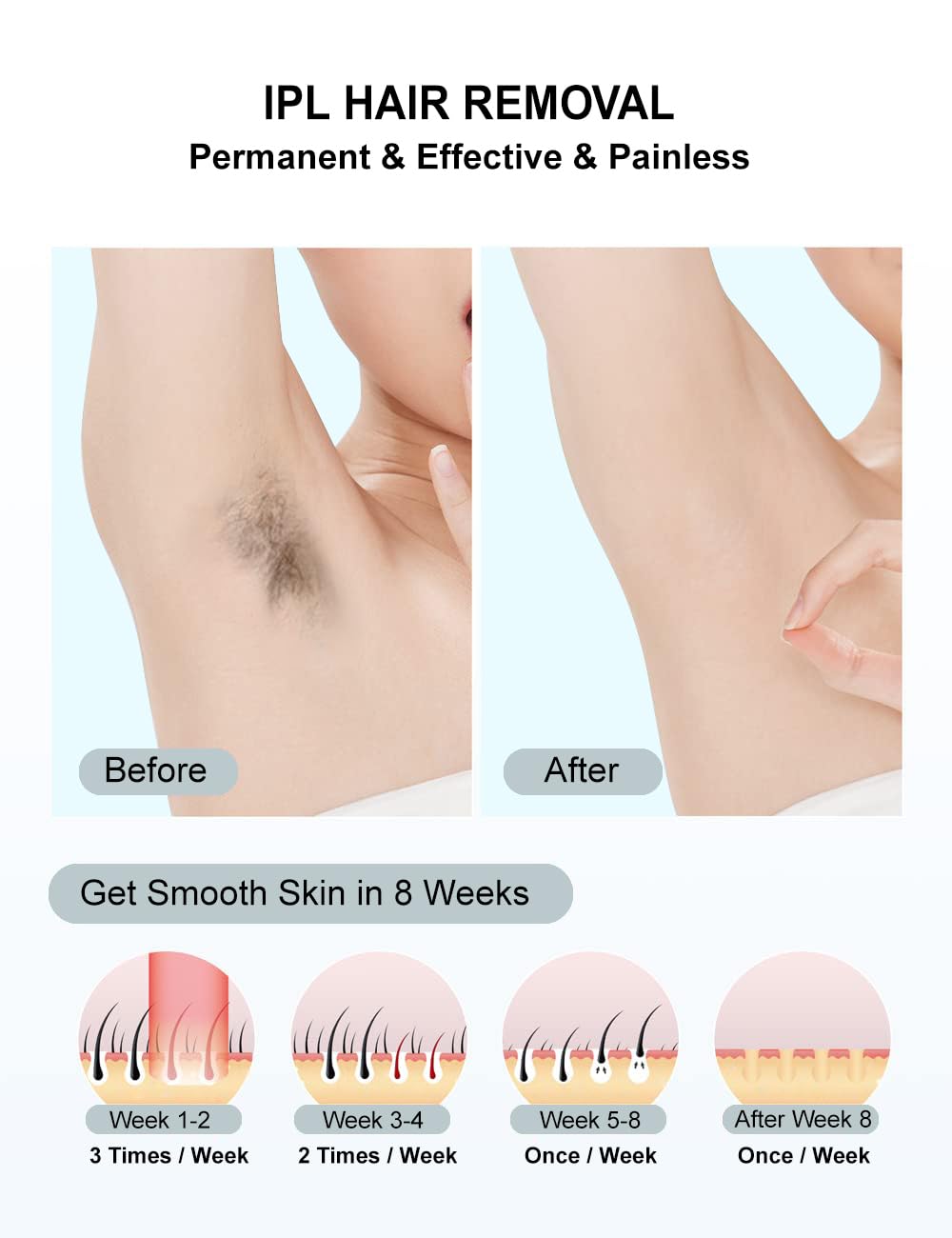 IPL Laser Hair Removal 999,999 Flashes A8611